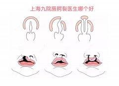 上海九院唇腭裂专科医生排名，看上海九院唇腭裂医生哪个好