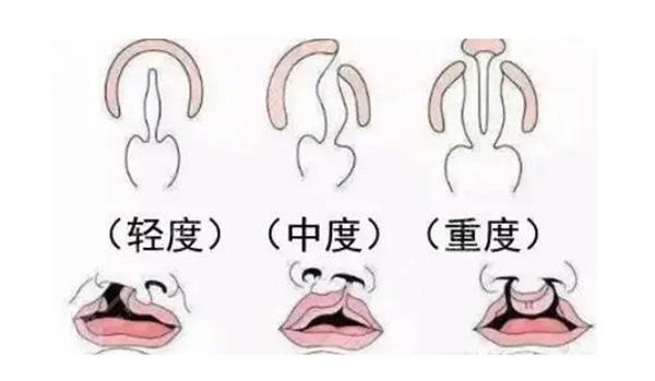 上海九院唇腭裂专科医生排名