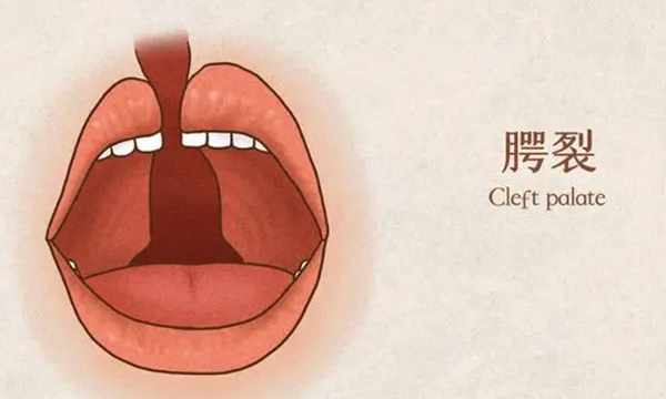 上海九院唇腭裂专科医生排名