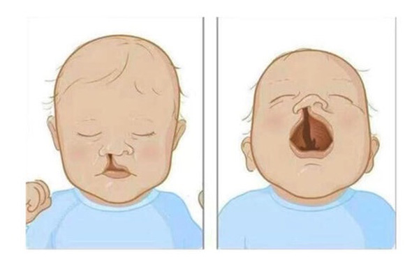 上海九院唇腭裂专科医生排名