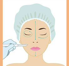 求问内切去眼袋是有风险的吗？想知道内切去眼袋怎么护理好