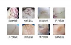 上海疤痕修复医院十强名单来袭，虹桥/清沁/时光