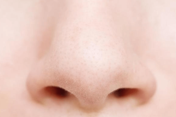 鼻整形
