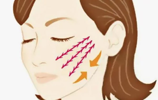 挤破头都要做的风筝小拉皮手术好吗?风筝小拉皮能维持多久