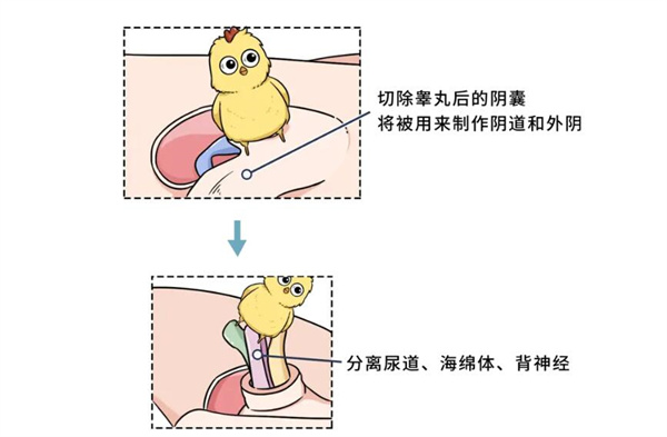 变性