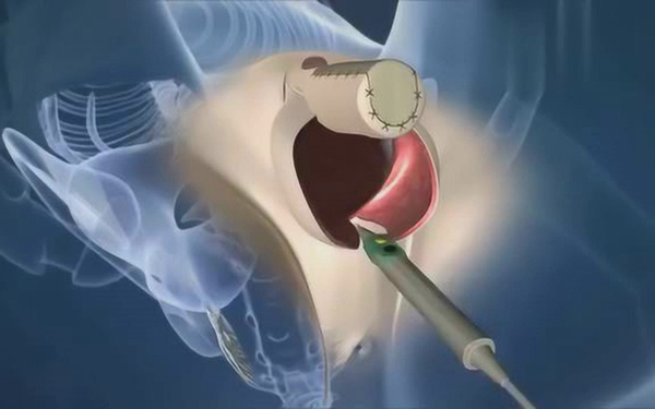 国内变性手术医院咨询及微信联系方式