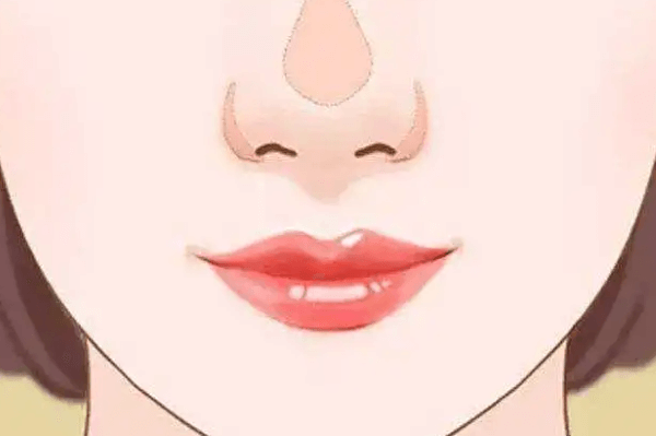 玻尿酸隆鼻