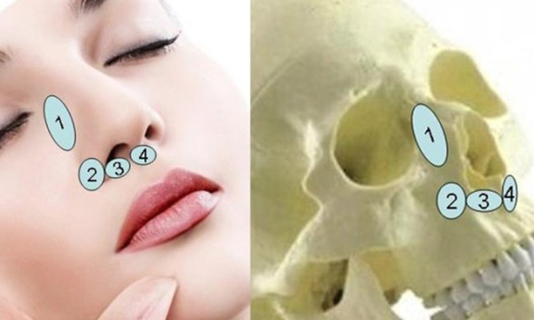 鼻基底填充是什么