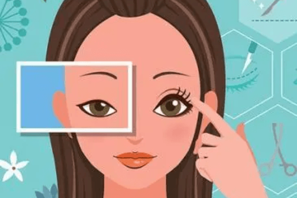 杜园园医生在哪家医院坐诊？听说杜园园修复双眼皮技术高超