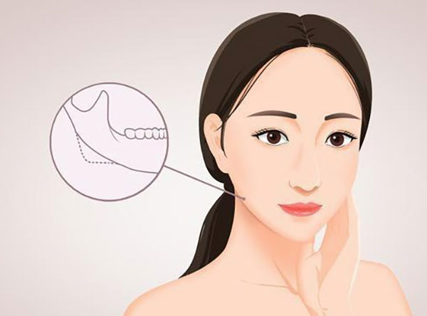 辽宁杏林整形外科医院怎么样