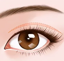 大连爱德丽格做双眼皮怎么样？可挂号刘志刚/王香平/宋立男眼修复