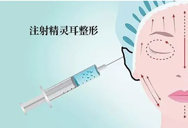 精灵耳整形多少钱?价格不贵手术成果好的医院有推荐吗?