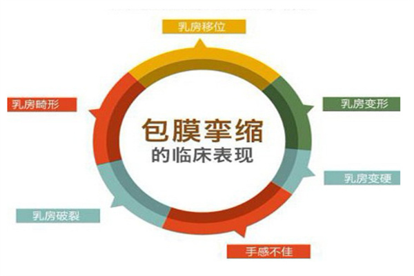 假体隆胸的问题如何避免