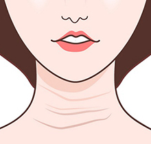 脖子上有皱纹怎么办?告诉你脖子上有皱纹怎么消除