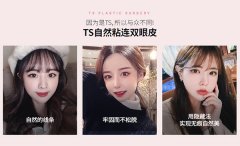 韩国TS整形外科医院眼睛实例太绝了，韩国双眼皮医院榜单必选
