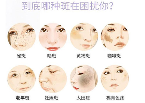 皮秒祛斑有效吗?