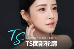 韩国ts整形医院做轮廓怎么样？韩国本地人非常受欢迎的网红医院了