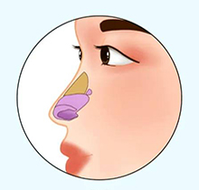 刘彦军做鼻子怎么样?隆鼻技术特色+刘彦军医生介绍做鼻子多少钱一览