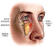 下眼睑切口面部提升术多少钱?多久修复?同时解决眼袋、泪沟成效好