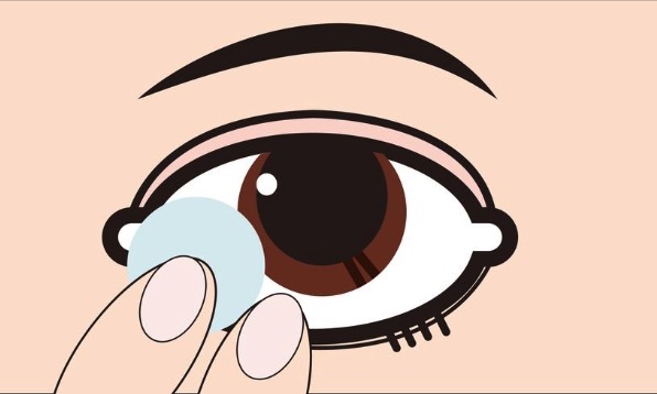 ok镜一旦停用会暴涨度数是真的吗?来看儿童到底该不该戴OK镜