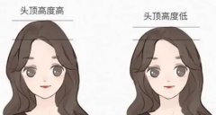 幼态脸填充打的是什么产品?宝尼达/伊妍仕/乔雅登不同部位材料慎选