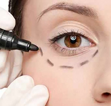 眼修复是找刘风卓还是王世勇？眼修复怎么样技术价格对比