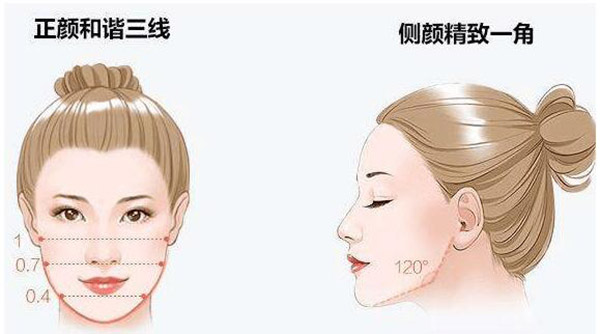 黄大勇下颌角怎么样?