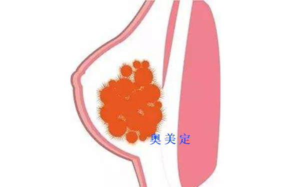 国内捷克水分子丰胸取出医院排名