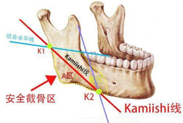 重庆华美潘宝华磨骨怎么样