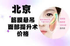 北京筋膜悬吊面部提升术价格多少钱?请参考2023北京做除皱价格表