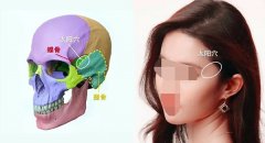 头包脸怎么填充好看？玻尿酸填充和骨水泥填充完成“头包脸”骨相设