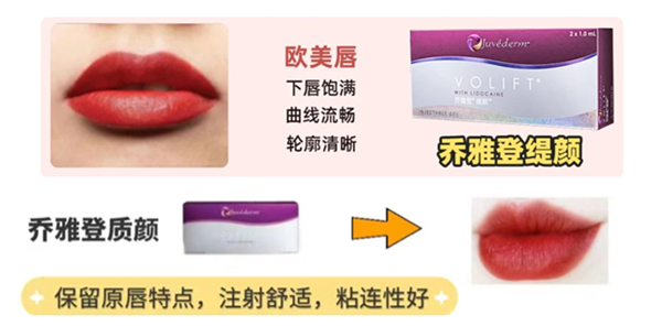 打嘟嘟唇用什么玻尿酸哪个牌子好?瑞蓝/乔雅登/伊婉/姣兰