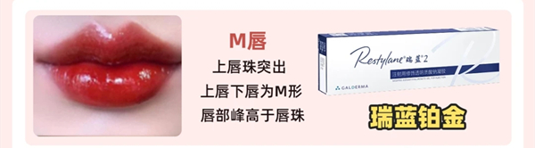 打嘟嘟唇用什么玻尿酸哪个牌子好?瑞蓝/乔雅登/伊婉/姣兰