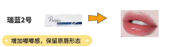 打嘟嘟唇用什么玻尿酸哪个牌子好?瑞蓝/乔雅登/伊婉/姣兰