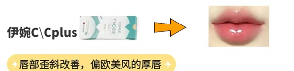 打嘟嘟唇用什么玻尿酸哪个牌子好?瑞蓝/乔雅登/伊婉/姣兰