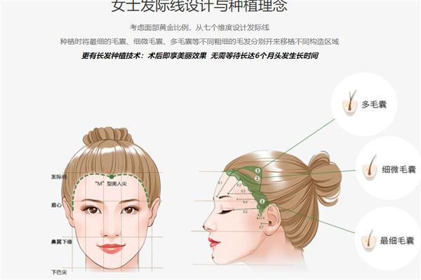 华美植发医院女性发际线设计