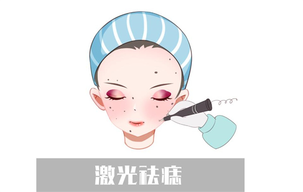激光点痣有大坑正常吗