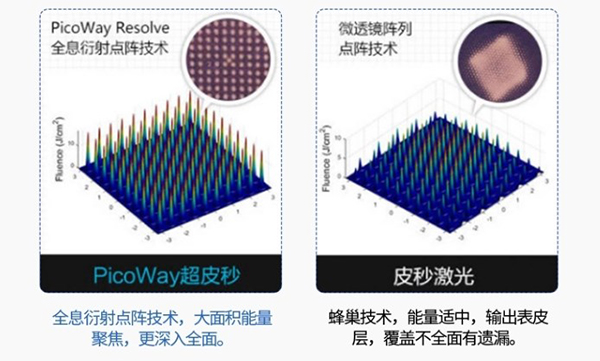 PicoWay超皮秒术后注意事项