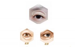 上眼窝凹陷用什么填充较好？上睑凹陷图片及填充治疗方法解析