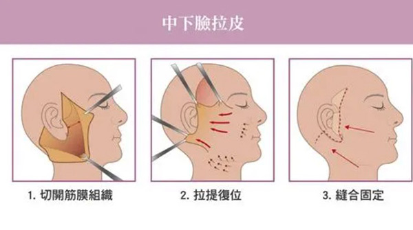 北京八大处拉皮手术哪个医生好?杨欣/王佳琦/解芳医生等技术好