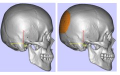 国内后脑勺填充的医院有哪些？排名里还是上海时光整形更好一些