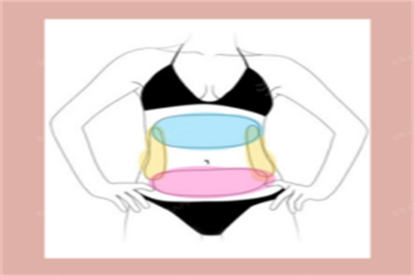 腹壁成形术多久能修复正常生活-腹壁成形术后还能生孩子吗？