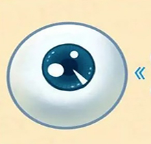 lasik手术是什么？告诉你和飞秒的区别都在哪里