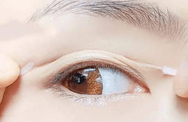 北京嘉禾医疗美容医院李燕医生修复眼睛怎么样