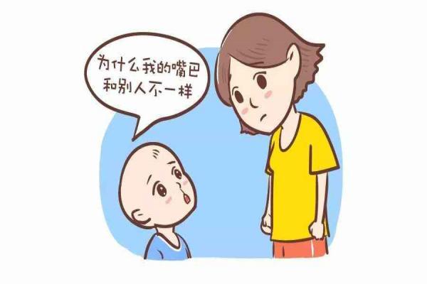 小孩唇腭裂