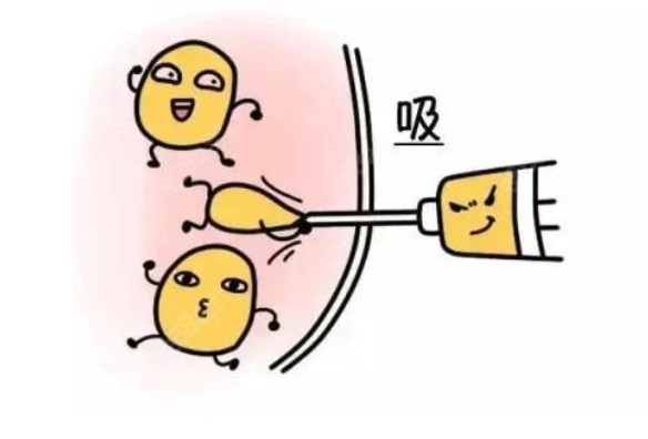 大腿抽脂肪多久可以修复？来看大腿抽脂会不会有后遗症