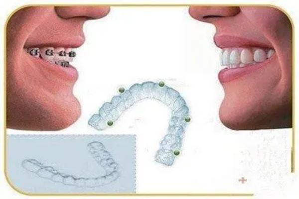 西安市口腔医院排行榜