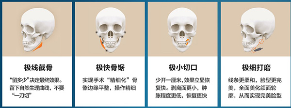 黄大勇磨骨要多少钱