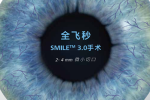 全飞秒激光近视手术度数要求范围是多少?1000度以都可做附价格