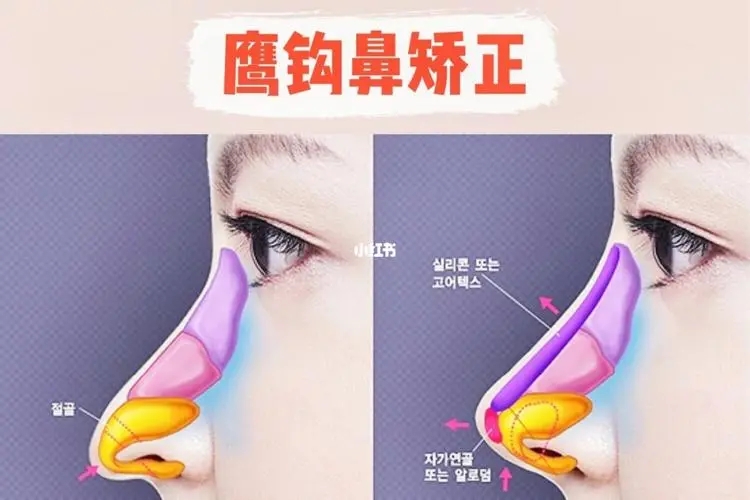 长沙希美整形医院价目表特殊公布！附柯晴方、李正茂两位骨干医生口碑评价